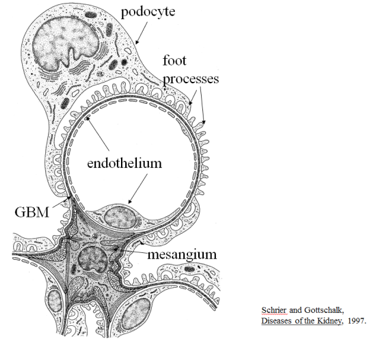 diagram depicting diseases of the kidney